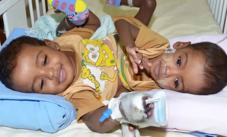 إنجاز طبي غير مسبوق في ودمدني إنجاز طبي غير مسبوق في ودمدني